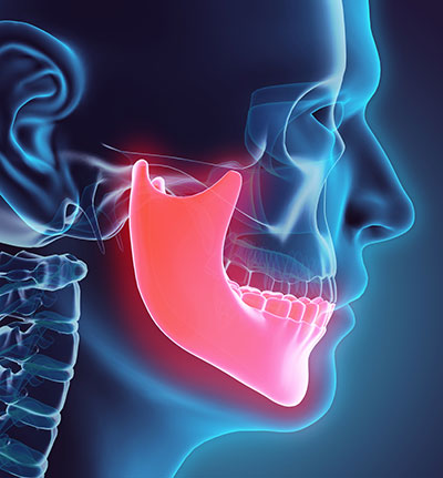 Diagram of a jaw bone